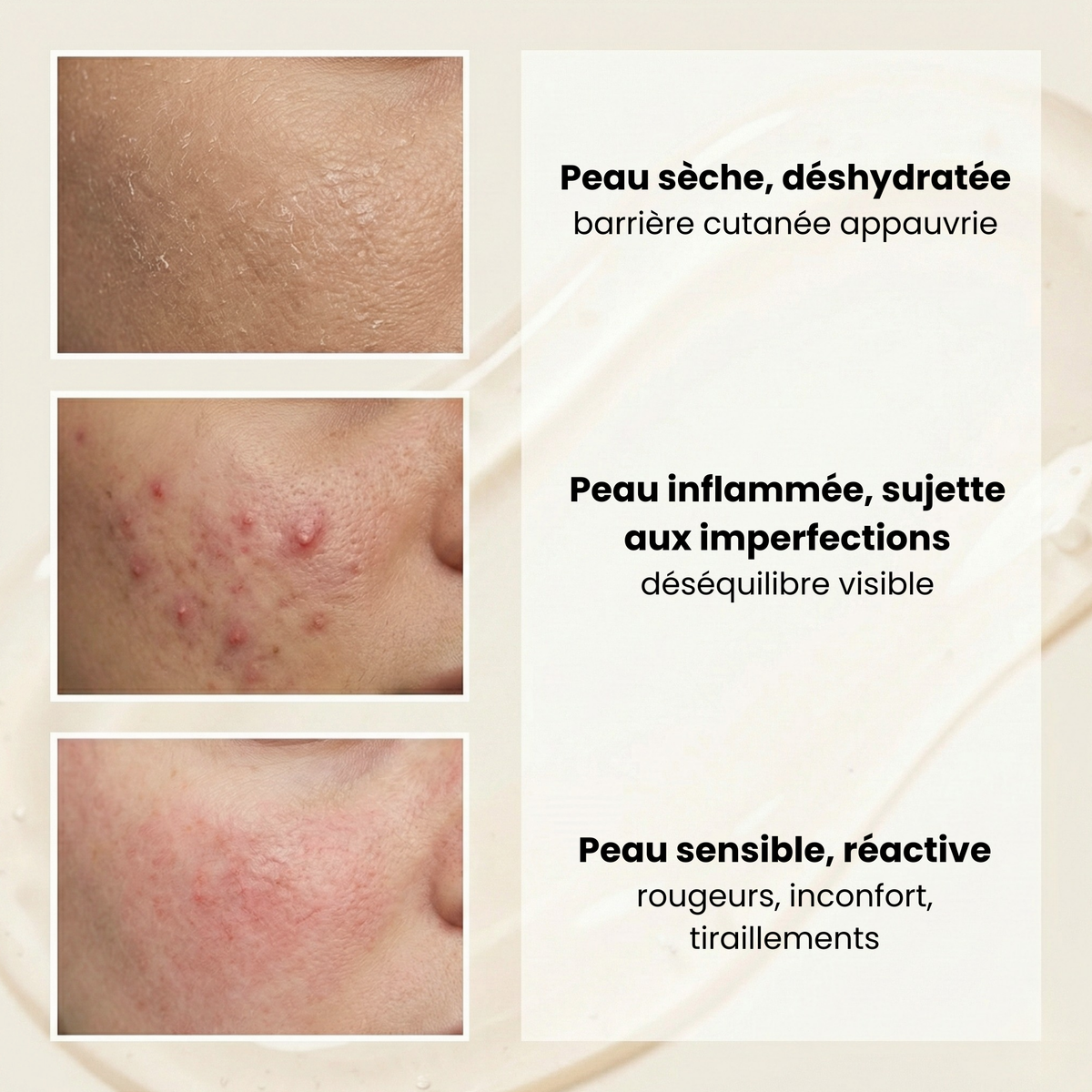 Le sérum apaisant pour peaux fragilisées