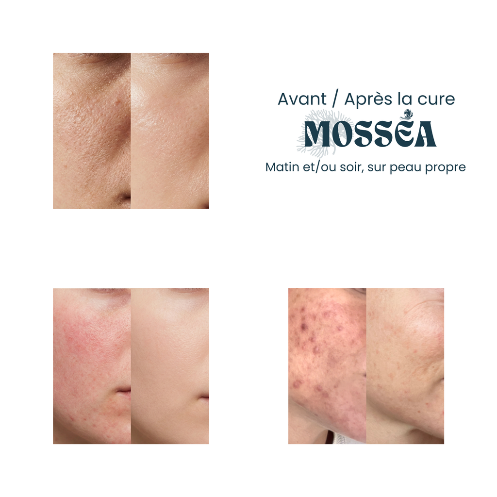 Le sérum apaisant pour peaux fragilisées